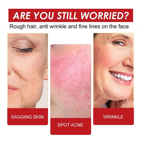  EELHOE Rosehip Serum cashymart