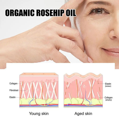  EELHOE Rosehip Serum cashymart