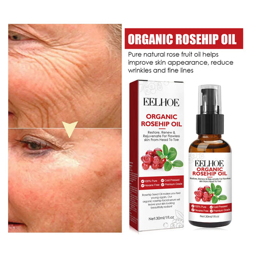  EELHOE Rosehip Serum cashymart