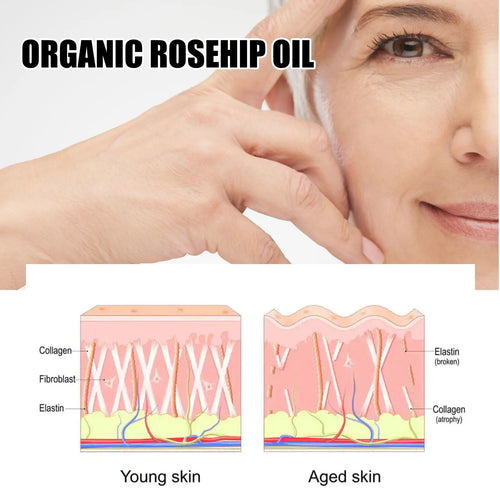  EELHOE Rosehip Serum cashymart