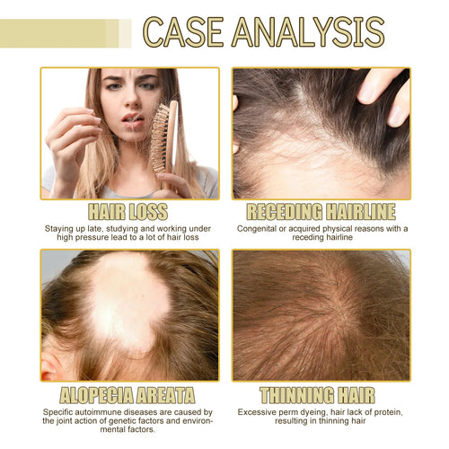  EELHOE Rosemary Oil for Hair Growth 60ml cashymart