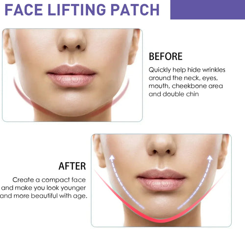  EELHOE V-Shaped Face Lifting Patches cashymart