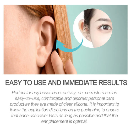  Eelhoe Cosmetic Ear Corrector cashymart