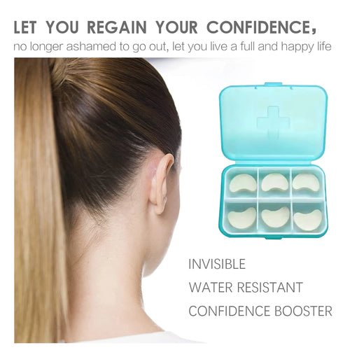  Eelhoe Cosmetic Ear Corrector cashymart