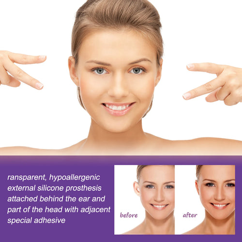  Eelhoe Cosmetic Ear Corrector cashymart