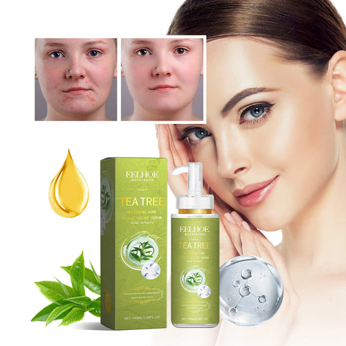  Eelhoe Tea Tree Essence cashymart