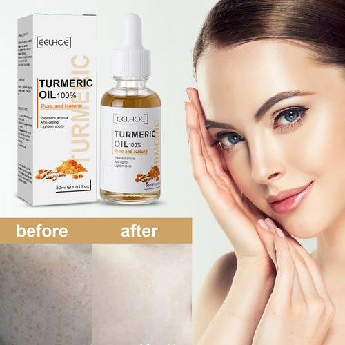  Eelhoe Turmeric Serum cashymart