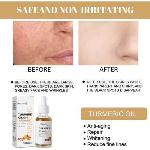  Eelhoe Turmeric Serum cashymart