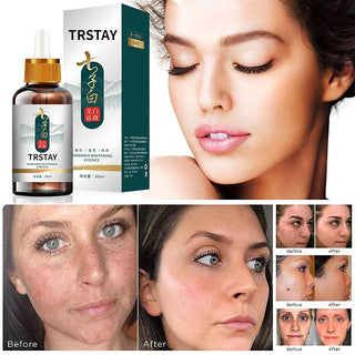  Effective Whitening Serum cashymart