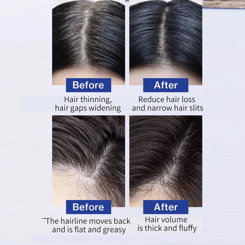  FEG Hair Growth Spray cashymart