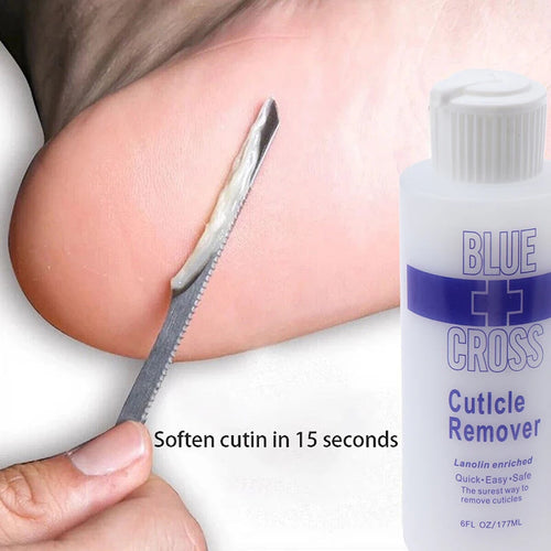  Foot Exfoliator Softener for Dead Skin Removal cashymart