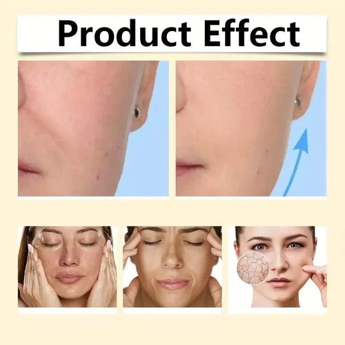  Frankincense Facial Cream for Tightening and Brightening cashymart