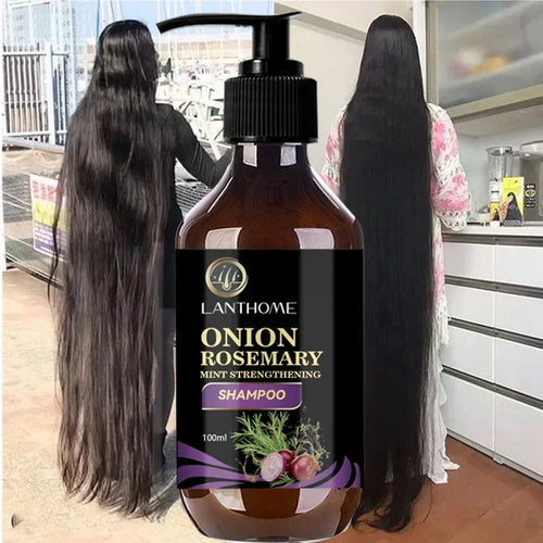  Hair Growth Thickening Shampoo with Rosemary Onion cashymart