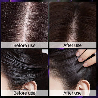  Hair Growth Thickening Shampoo with Rosemary Onion cashymart