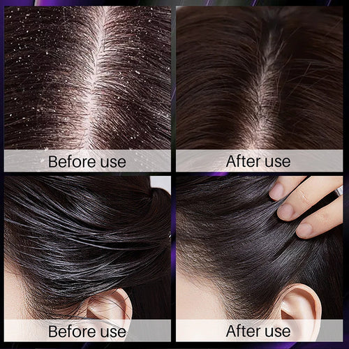  Hair Growth Thickening Shampoo with Rosemary Onion cashymart