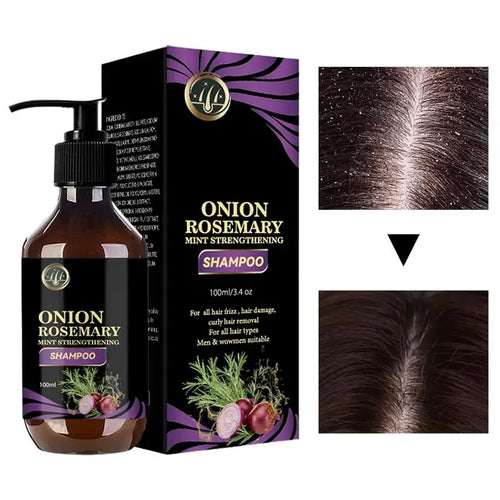  Hair Growth Thickening Shampoo with Rosemary Onion cashymart