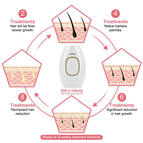 Home Use Laser Hair Removal Device cashymart