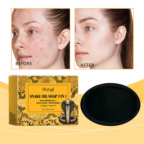 Hoygi Snake Oil Facial Cleansing Soap 100g cashymart