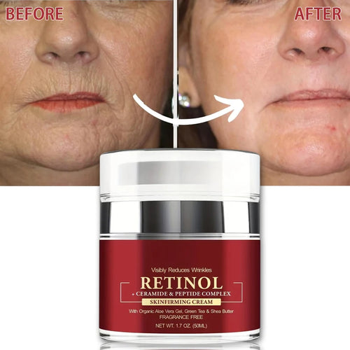  Instant Retinol Cream for Firming & Lifting Skin cashymart