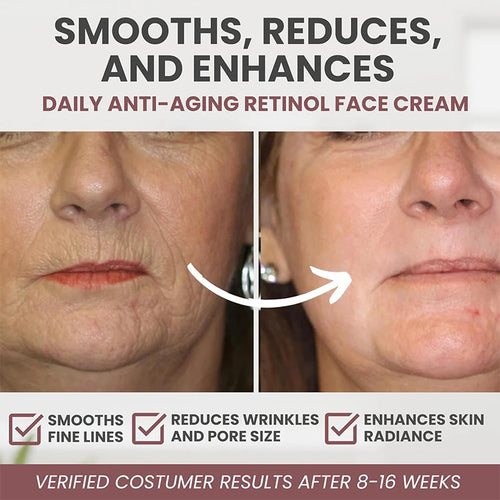  Instant Retinol Cream for Firming & Lifting Skin cashymart