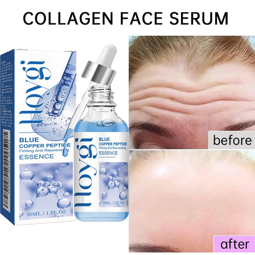 Instant Wrinkle Remover cashymart