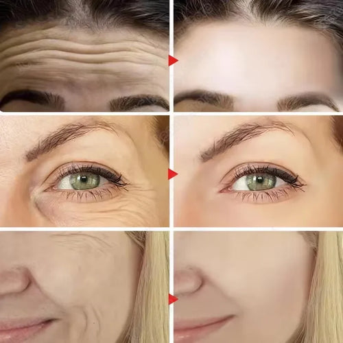  Instant Wrinkle Remover cashymart