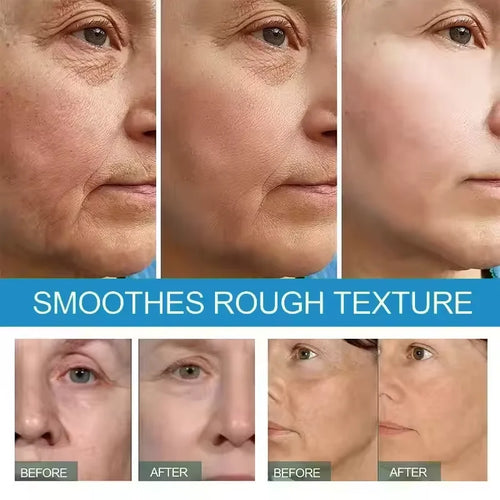  Instant Wrinkle Remover cashymart