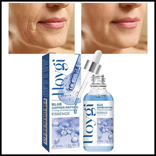  Instant Wrinkle Remover cashymart