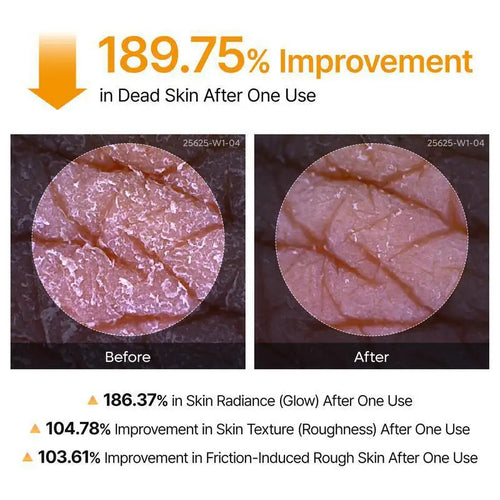  Kojic Acid Turmeric Body Scrub Spray cashymart