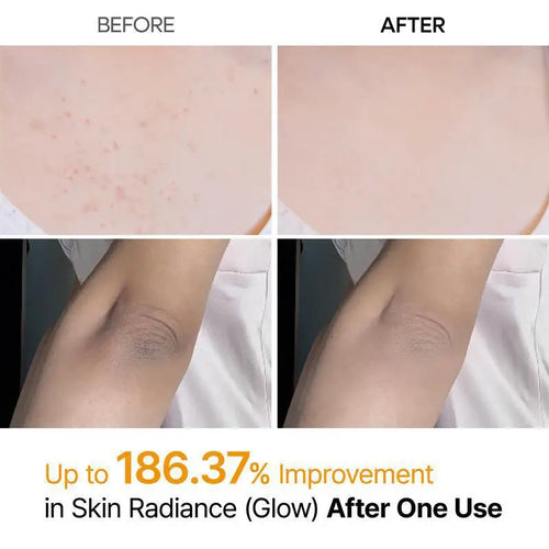  Kojic Acid Turmeric Body Scrub Spray cashymart