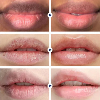  Korean Pink Lip Balm cashymart