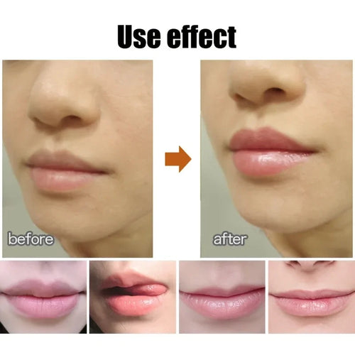  Lip Balm Ball cashymart