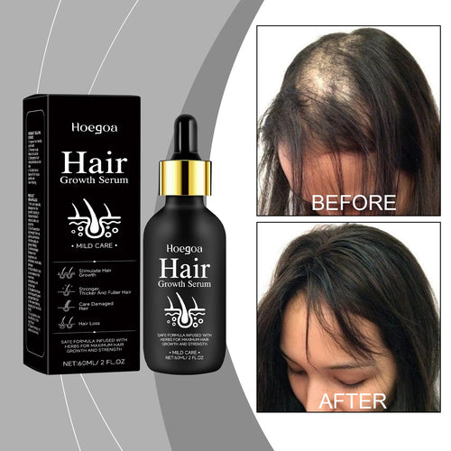  Natural Hair Growth Oil for Men and Women 60ml cashymart