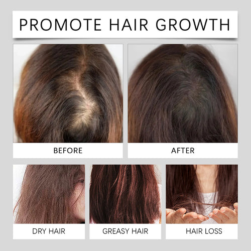  Natural Hair Growth Oil for Men and Women 60ml cashymart