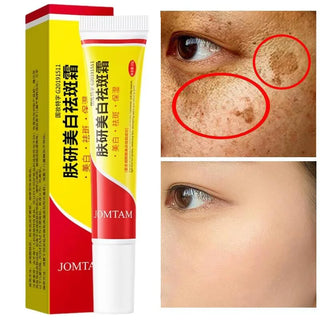  Niacinamide Face Lightening Cream cashymart