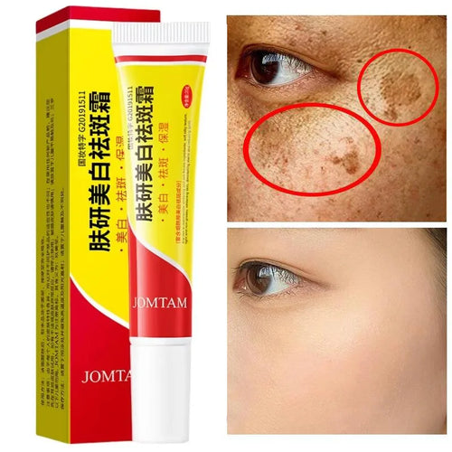  Niacinamide Face Lightening Cream cashymart