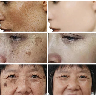  Niacinamide Face Lightening Cream cashymart
