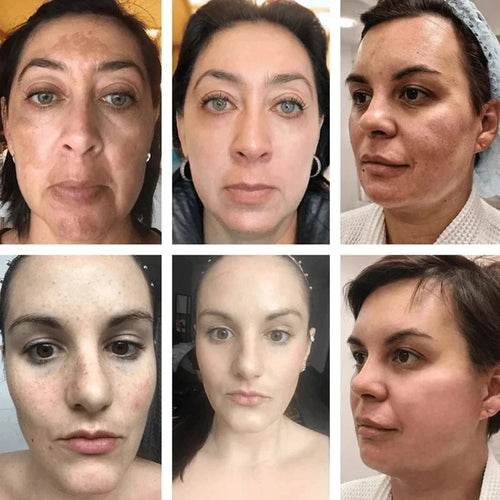  Niacinamide Face Lightening Cream cashymart