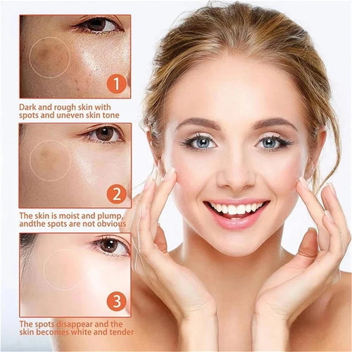  Niacinamide Face Lightening Cream cashymart