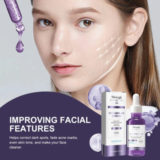  Niacinamide Serum for Dark Spots and Brightening cashymart