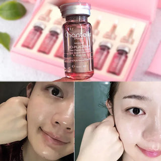  Original Chantelle Pink BioPlacenta Serum cashymart