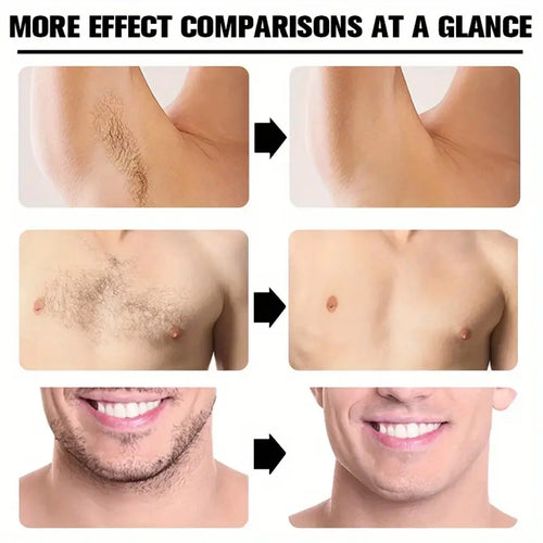  Painless Hair Removal Cream for Body Care cashymart