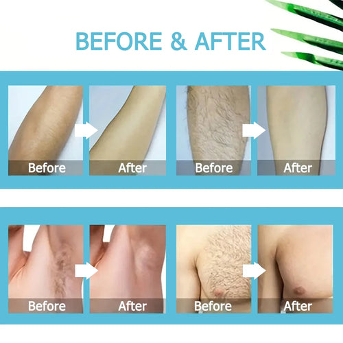  Painless Hair Removal Cream for Men and Women cashymart