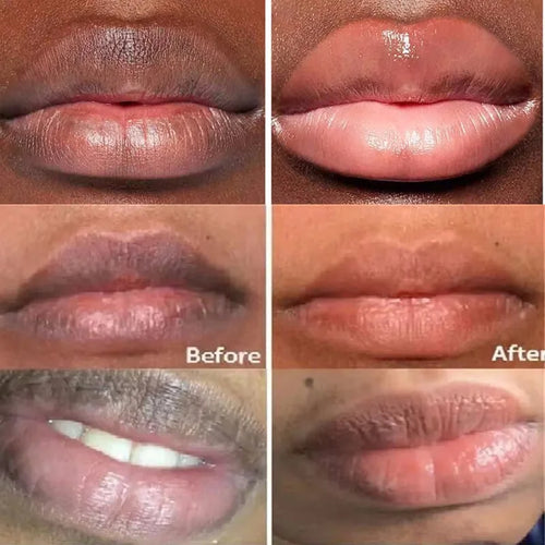  Pink Lip Renewal Cream cashymart