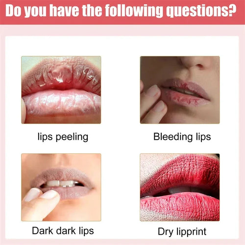  Pink Lip Renewal Cream cashymart