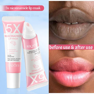  Remove Dark Lip Balm Lightening Treatment cashymart