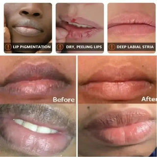  Remove Dark Lip Balm Lightening Treatment cashymart