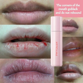 Remove Dark Lip Balm Moisturizing Gloss for Beautiful Lips cashymart