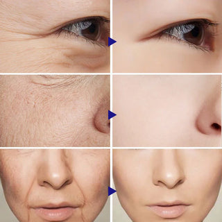  Retinol Anti Aging Face Cream for Wrinkles cashymart