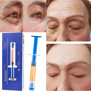  Retinol Anti Aging Face Cream for Wrinkles cashymart